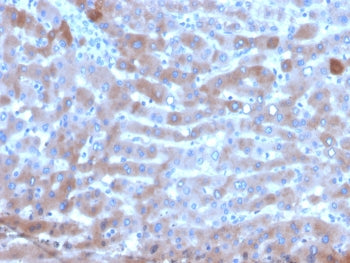 Transferrin Antibody