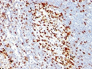 IHC: Formalin-fixed, paraffin-embedded human tonsil stained with ZAP70 antibody (clone ZAP70/528).