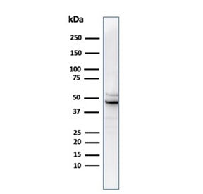 Western blot analysis of human PC3 cell lysate using recombinant Ornithine Decarboxylase antibody (c