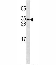 PDGFC Antibody