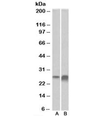 Western blot testing of human kidney [A] and liver [B] lysate with APOD antibody at 0.3ug/ml. Predicted molecular weight: ~21/21-33kDa (unmodified/glycosylated).