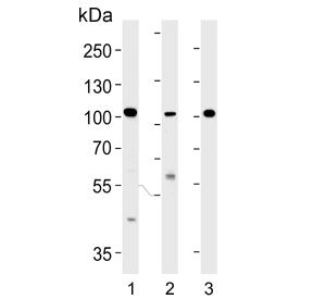NCOA7 Antibody / Nuclear receptor coactivator 7