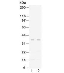 Western blot testing of human 1) CEM and 2) A549 lysate with CXCL16 antibody at 0.5ug/ml. Predicted 