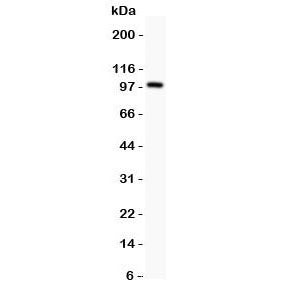 Prothrombin Antibody (Thrombin)