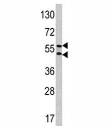 CA9 Antibody