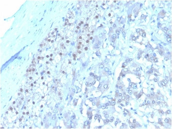 IHC staining of FFPE human adrenal gland tissue with IL3 antibody (clone I L3/4001). HIER: boil tiss