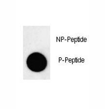 LC3B Antibody / MAP1LC3B (pT29), 0.4ml
