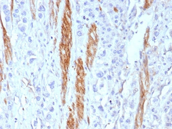 NCAM / CD56 Antibody