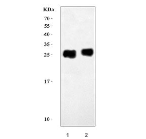 Western blot testing of 1) rat heart and 2) mouse heart tissue lysate with Troponin I antibody. Expe