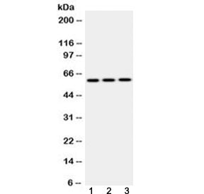Western blot testing of 1) rat lung, 2) mouse lung and 3) HepG2 lysate with EPHX2 antibody at 0.5ug/