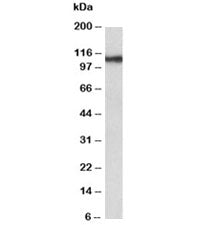 Thyroid Peroxidase Antibody
