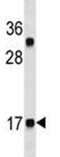 CGRP Antibody (CALCA)