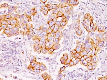 Phosphotyrosine Antibody / P-Tyr