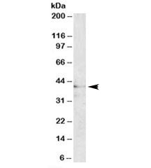 Western blot testing of human brain lysate with MC3R antibody at 1ug/ml. Predicted/observed molecula
