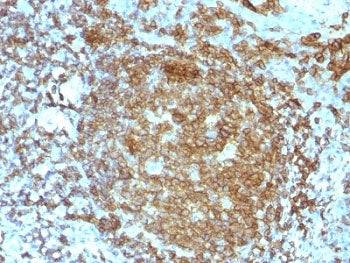 IHC test of FFPE human tonsil probed with CD45RA antibody. HIER: boil tissue sections in 10mM citrat