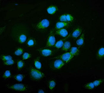 NCAM1 Antibody / CD56