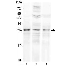 Western blot testing of 1) rat ovary, 2) human HeLa and 3) human placenta lysate with FGF8 antibody 