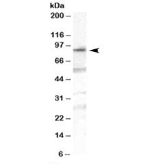 Western blot testing of human duodenum lysate with OSBPL10 antibody at 1ug/ml. Predicted molecular w