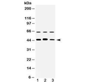 Western blot testing of 1) rat brain, 2) mouse brain and 3 human HeLa cell lysate with ARFGAP1 antib