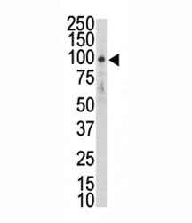 DDR2 Antibody