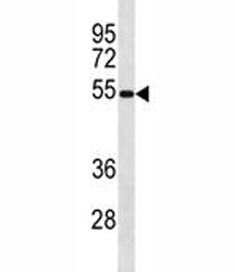 Mavs Antibody (Ips-1)