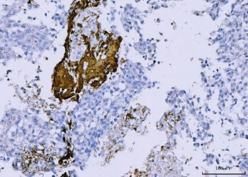 Integrin beta 3 Antibody / ITGB3 / CD61