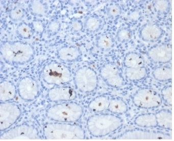 IHC staining of FFPE human H. pylori-infected stomach tissue with Helicobacter pylori Catalase antib