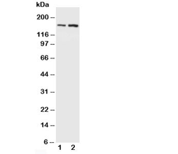 Western blot testing of NMDAR2B antibody and Lane 1: rat brain; 2: mouse brain. Predicted molecular 