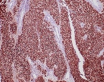 GATA3 Antibody