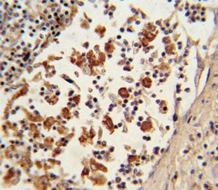 BCL6 Antibody