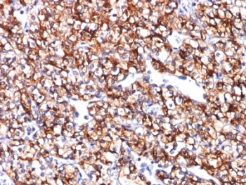 CA9 Antibody / Carbonic Anhydrase IX