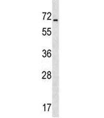 ACCN4 Antibody / ASIC4