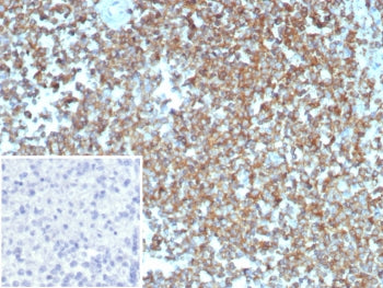 Beta Actin Antibody / ACTB