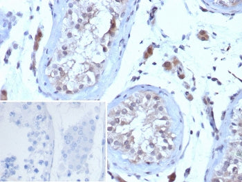 IHC staining of FFPE human testis tissue with Choriogonadotropin Receptor antibody (clone LHCGR/7398