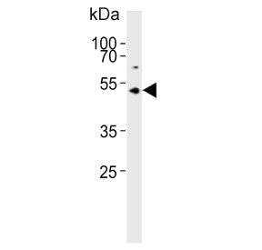 ASMT Antibody / Acetylserotonin O-methyltransferase