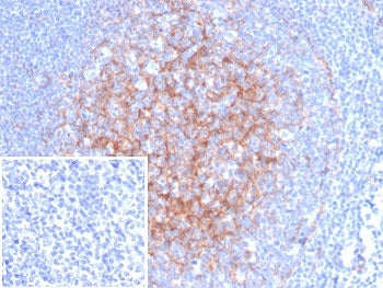 IHC staining of FFPE human tonsil tissue with ICAM-1 antibody (clone ICAM1/6968). Inset: PBS used in