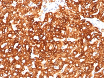 IHC staining of FFPE human liver tissue with Haptoglobin antibody (clone HP/3838). HIER: boil tissue