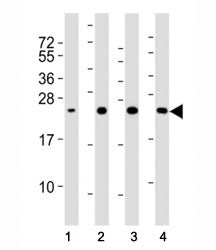 Superoxide Dismutase 2 Antibody (SOD2)