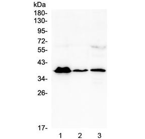 MR1 Antibody / MHC class I related protein 1