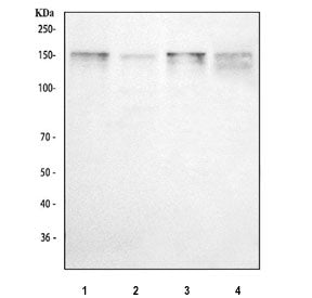 Thrombospondin Antibody / THBS1