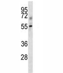 Tgfbr1 Antibody