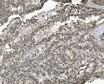 Prohibitin 2 Antibody / PHB2