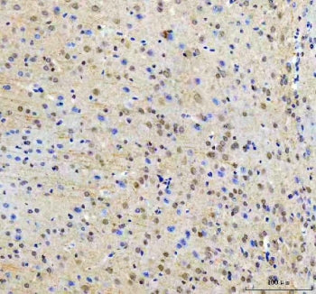 RTF1 Antibody / RNA polymerase-associated protein RTF1 homolog