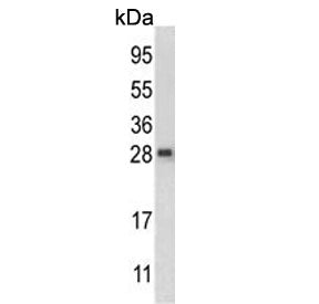 Western blot testing of mouse liver tissue lysate with QDPR antibody. Predicted molecular weight ~26