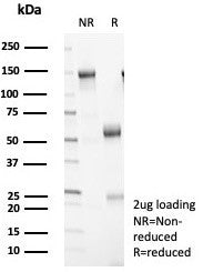SDS-PAGE analysis of purified, BSA-free 14-3-3 epsilon antibody (clone YWHAE/8309R) as confirmation 