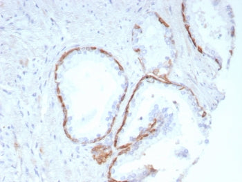IHC staining of FFPE human prostate tissue with KRT14 antibody (clone KRT14/8691R). HIER: boil tissu