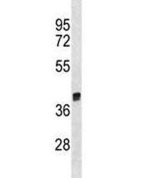 Arginase 1 Antibody (Arg1)