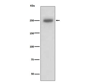 Laminin beta 1 Antibody / LAMB1