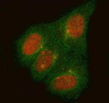 Immunofluorescent staining of FFPE human HeLa cells with C14orf50 antibody (red) and Alpha Tubulin m