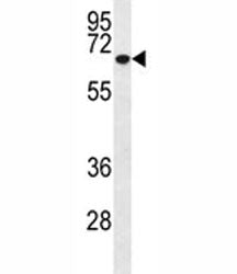 MMP2 Antibody